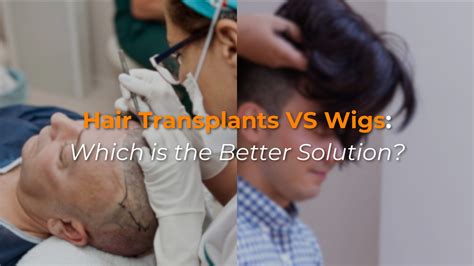 Wigs: A Solution for Hair Loss and Style Transformation