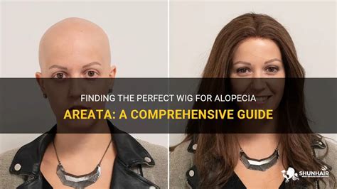 Wigs for Alopecia: A Comprehensive Guide for Enhancing Appearance and Confidence