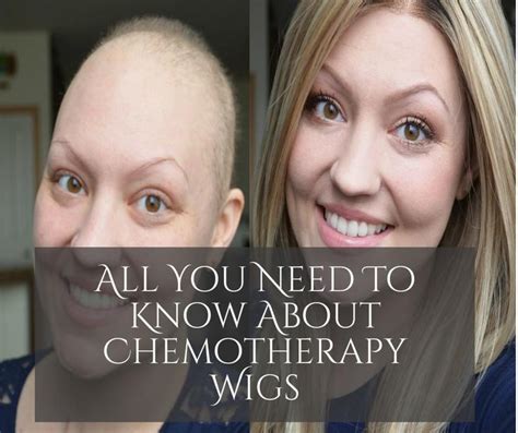 Wigs for Chemo Patients: Everything You Need to Know