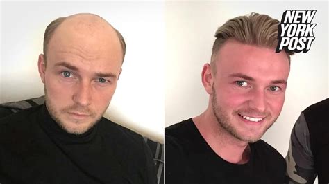 Wigs vs. Bald Men: Blonde 4" Cropped Wigs for 2025