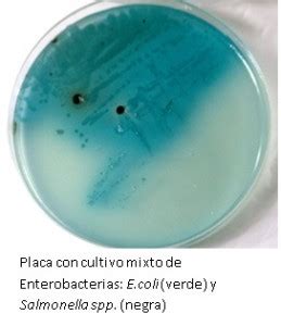 Wilson and Blair Medium: Your Secret Weapon for Salmonella Detection