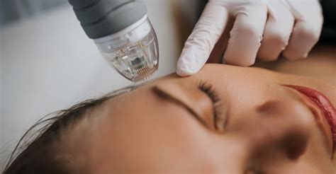 Wilsonesthetics: A Comprehensive Guide to Advanced Aesthetic Treatments