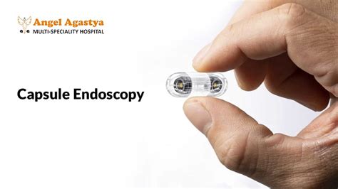 Windbreaker Endo: A Revolutionary Approach to Non-Invasive Endoscopy