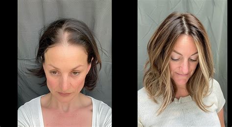 Women's Hair Toppers for a Glamorous Transformation