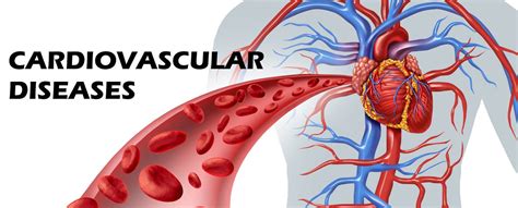 Wound Healing in Cardiovascular Disease PDF