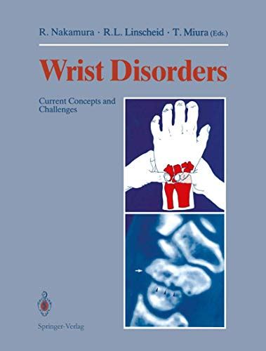 Wrist Disorders Current Concepts and Challenges PDF