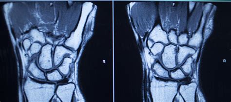 Wrist Imaging PDF