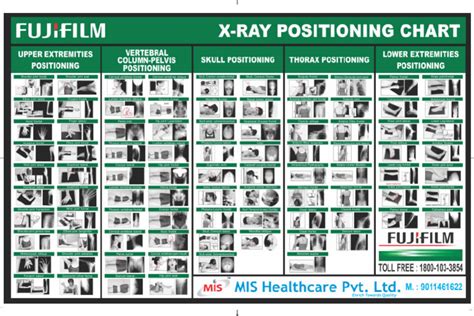 X Ray Position Chart