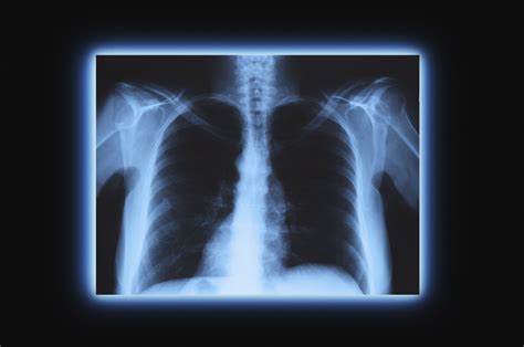 X-rays Epub