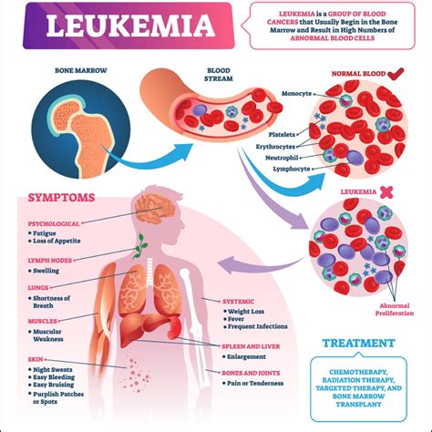 You and Leukemia PDF