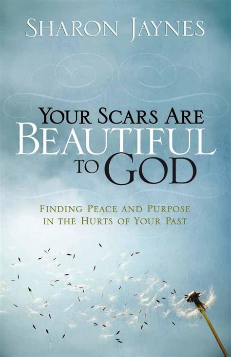 Your Scars Are Beautiful to God: Finding Peace and Purpose in the Hurts of Your Past Epub