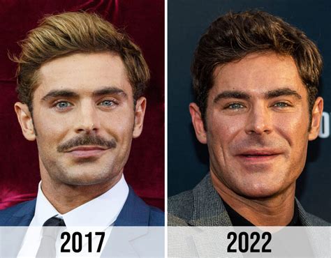 Zack Efron Before and After: A Transformation Journey