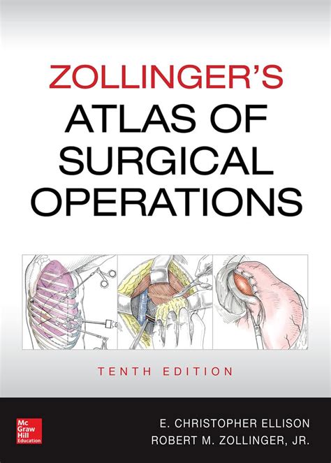 Zollinger s Atlas of Surgical Operations Tenth Edition Epub