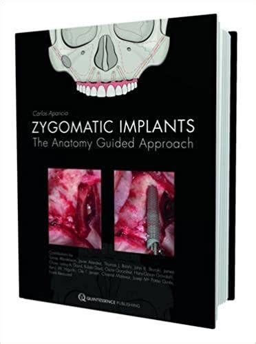 Zygomatic Implants: The Anatomy Guided Approach Ebook Reader