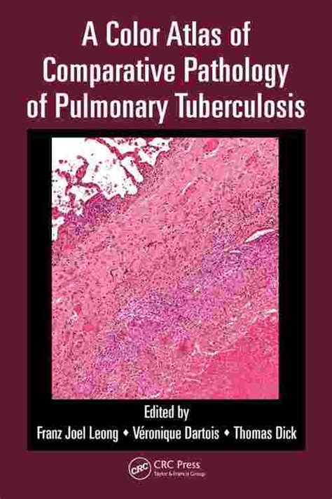 a color atlas of comparative pathology of pulmonary tuberculosis Epub