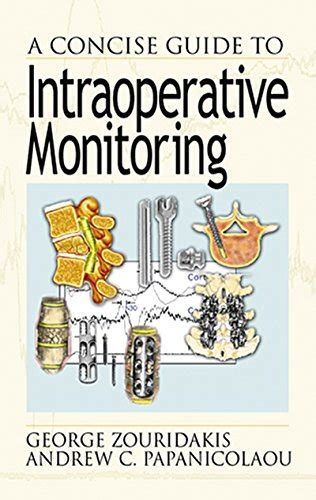a concise guide to intraoperative monitoring Ebook Epub