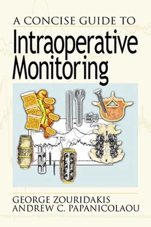 a concise guide to intraoperative monitoring Ebook Epub