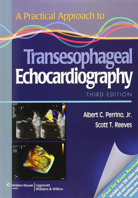 a practical approach to transesophageal echocardiography Reader