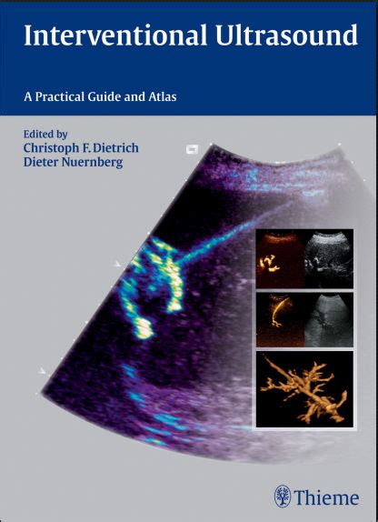 a practical guide to 3d ultrasound 1e 2015 pdf unitedvrg Reader