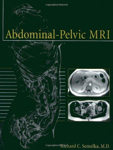 abdominal pelvic mri richard c semelka ebook PDF