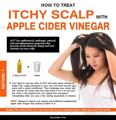 acv for dandruff