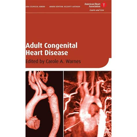 adult congenital heart disease american heart association clinical series PDF