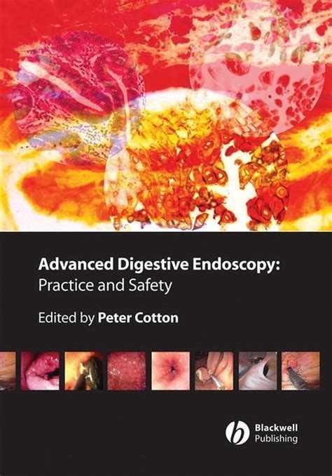 advanced digestive endoscopy advanced digestive endoscopy Reader