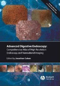 advanced digestive endoscopy advanced digestive endoscopy Reader