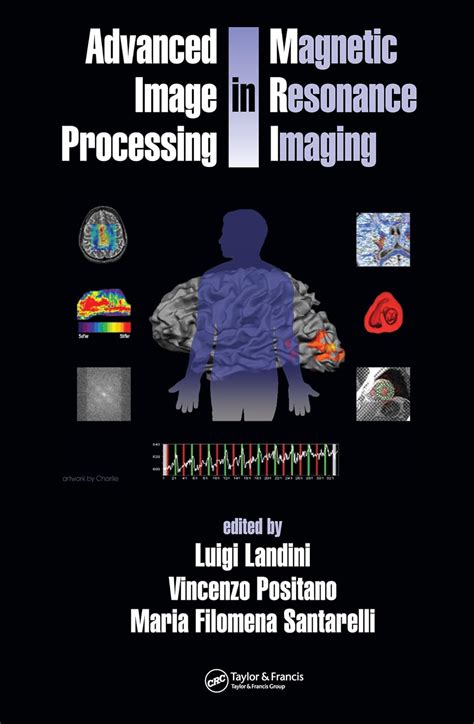 advanced image processing in magnetic resonance imaging signal processing and communications Reader