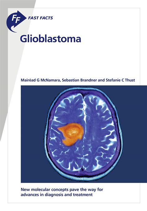 advances treatment newly diagnosed glioblastoma PDF