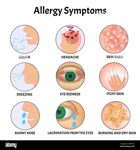 allergies and itchy skin