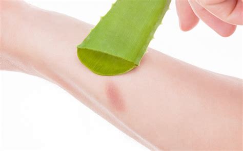 aloe4thatburn