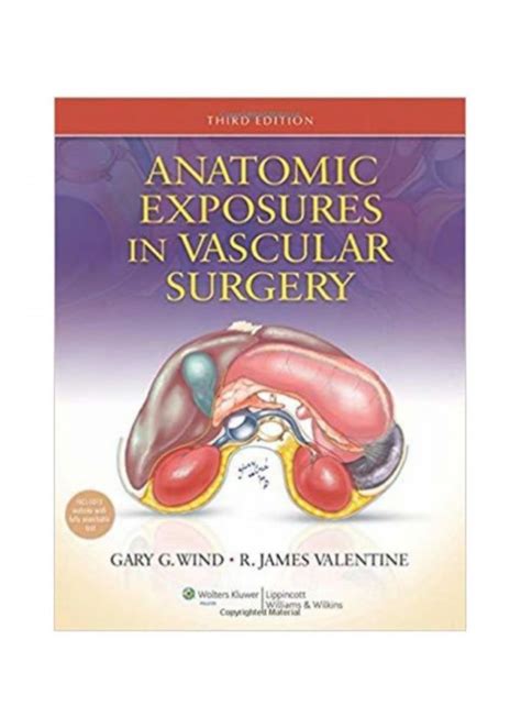 anatomic exposures in vascular surgery Kindle Editon