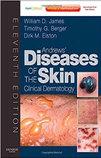 andrews diseases of the skin 11th edition pdf free download Doc