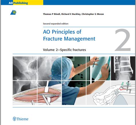 ao principles of fracture management Ebook Epub