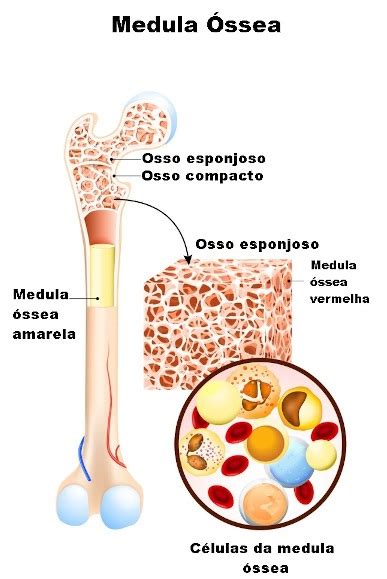 aplasia na medula