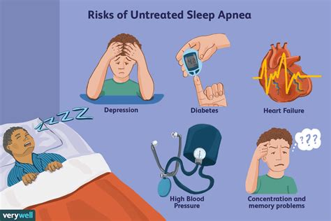 apnea no more easy sleep Reader