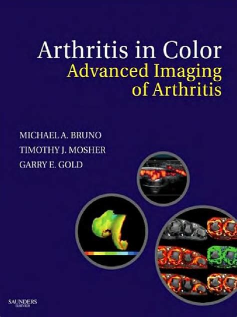 arthritis in color advanced imaging of arthritis 1e PDF