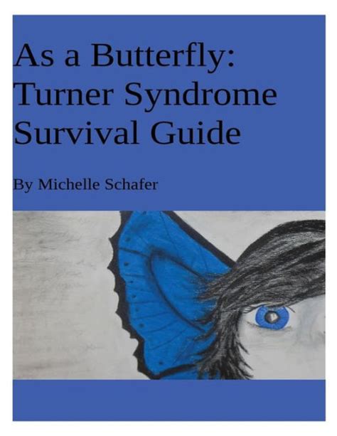 as a butterfly turner syndrome survival guide Kindle Editon
