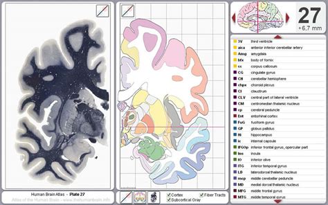 atlas of brain function atlas of brain function Kindle Editon