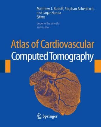 atlas of cardiovascular computed tomography atlas of cardiovascular computed tomography Doc