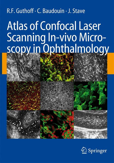 atlas of confocal laser scanning in vivo microscopy in ophthalmology Epub