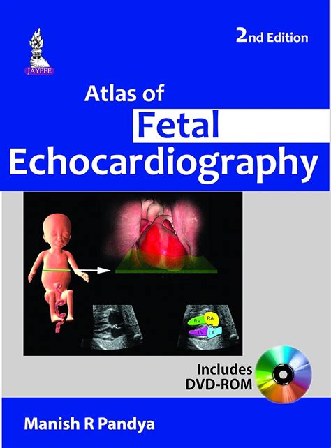 atlas of fetal echocardiography atlas of fetal echocardiography Kindle Editon