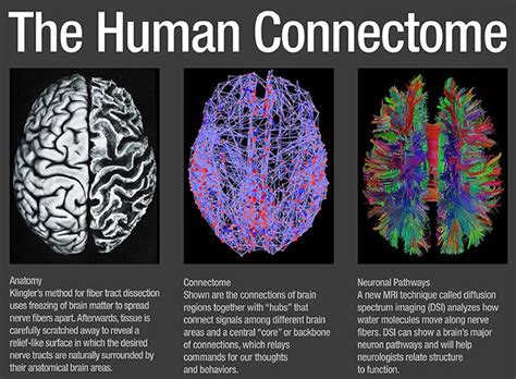 atlas of human brain connections atlas of human brain connections Doc