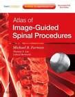 atlas of image guided spinal procedures 1e Doc