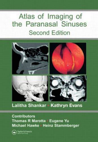 atlas of imaging of the paranasal sinuses second edition Reader