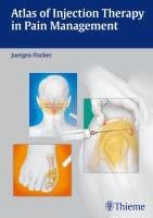 atlas of injection therapy in pain management Epub