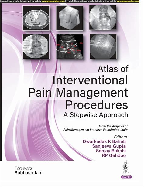 atlas of interventional pain management Ebook Doc