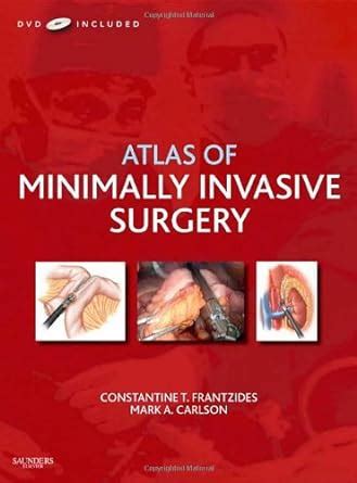 atlas of minimally invasive surgery with dvd Reader
