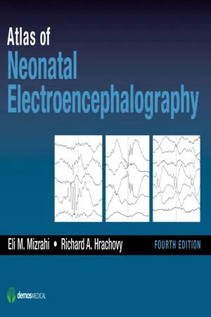 atlas of neonatal electroencephalography Kindle Editon
